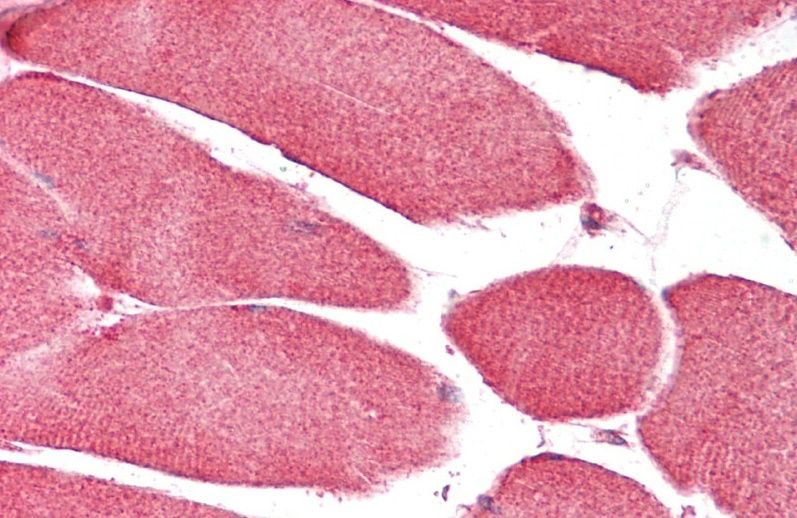 Goat anti-CHCHD3 Antibody