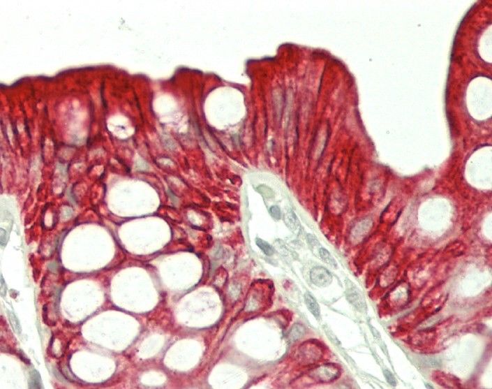 Mouse anti Cytokeratin 20