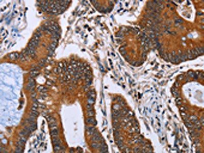 IHH Antibody
