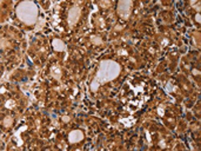 IHH Antibody
