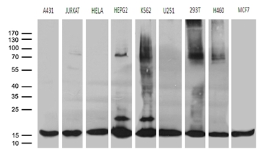 CCDC36 Antibody