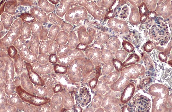 IKB alpha antibody