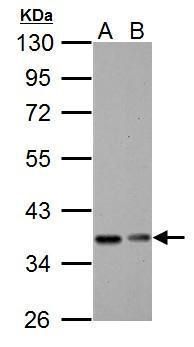 IKB alpha antibody