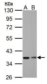 NFKB inhibitor alpha Antibody