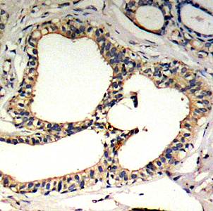 IkB-ε (Phospho-Ser22) Antibody