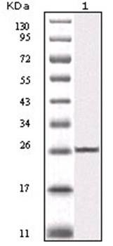 IKBKB Antibody