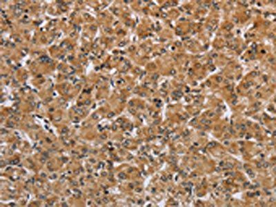 IKBKE Antibody