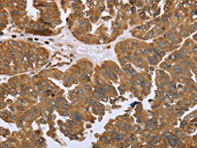IKBKE Antibody