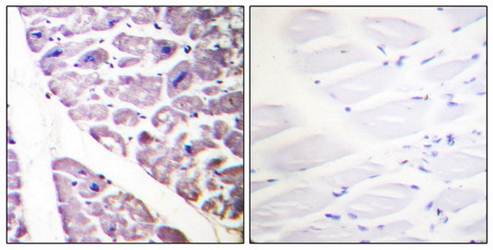 IKK-α (Phospho-Ser176) /IKK-β (Phospho-Ser177) Antibody