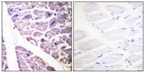 IKK-alpha/beta (phospho-Ser176/177) antibody