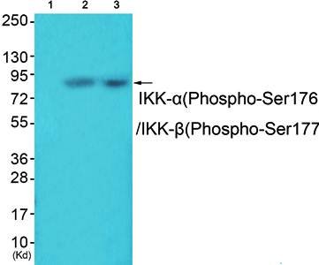 IKK-alpha/beta (phospho-Ser176/177) antibody
