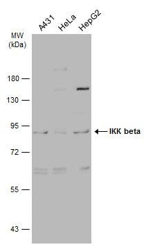 IKK beta antibody