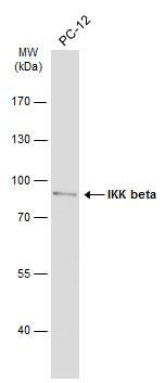 IKK beta antibody