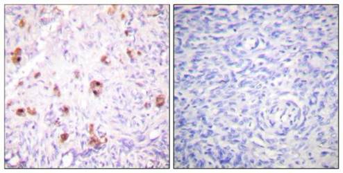 IKK-gamma (phospho-Ser31) antibody