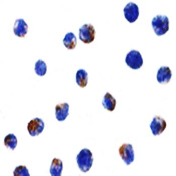 IKK alpha Antibody