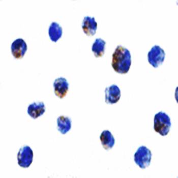 IKK alpha Antibody