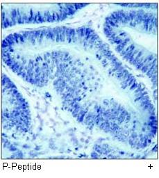 IKK α (Phospho-Thr23) Antibody