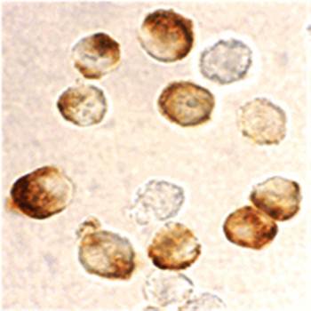 IKK beta Antibody