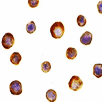 IKK gamma Antibody