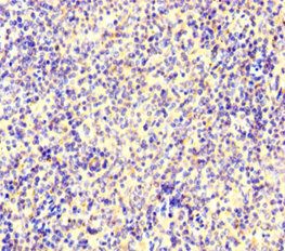 IKZF1 Antibody
