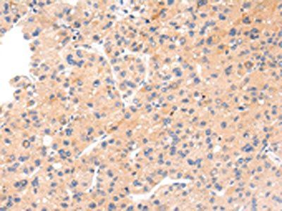 IKZF4 Antibody