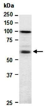 IKZF4 (N2) Antibody, Rabbit Polyclonal