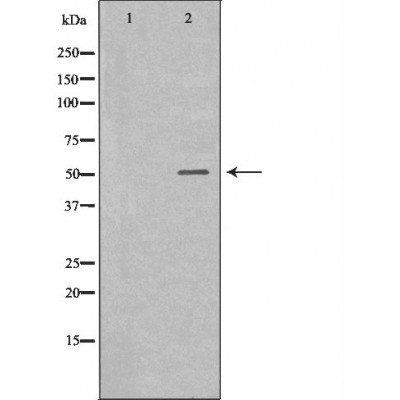 IL6R Antibody