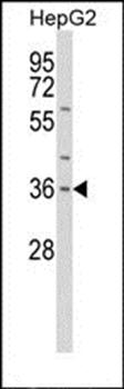 IL1 alpha antibody