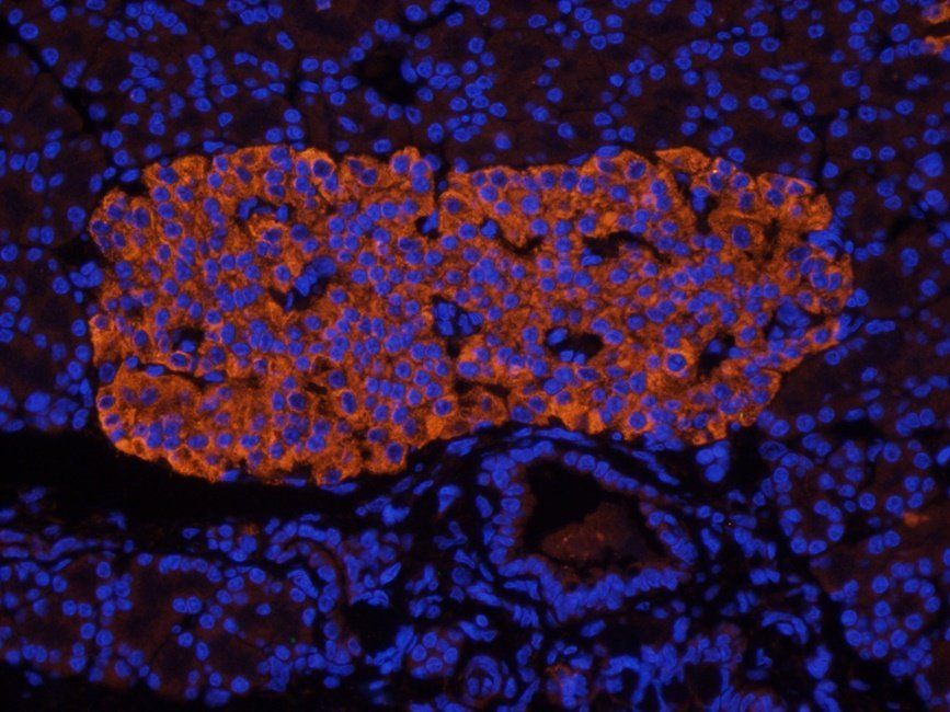 IL1 beta antibody