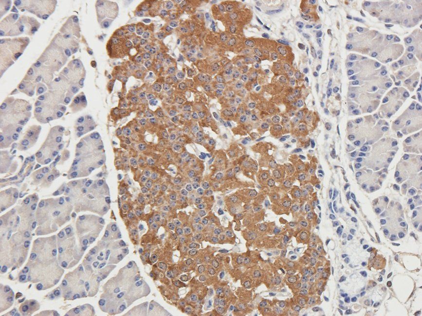 IL1 beta antibody