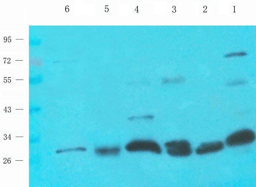 IL1 beta antibody