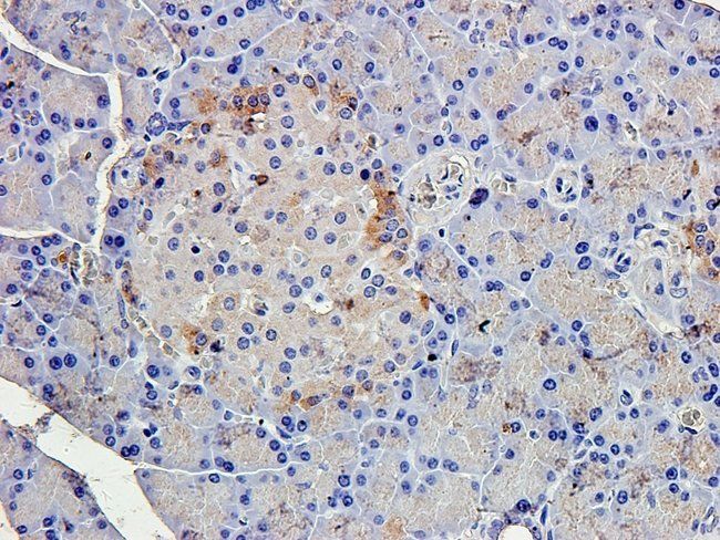 IL1 beta antibody