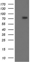 IL1B Antibody