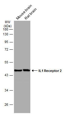 IL1 Receptor 2 antibody