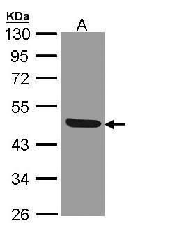IL1 Receptor 2 antibody