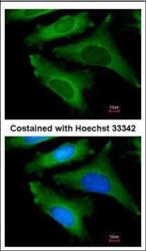 IL1 Receptor antagonist antibody