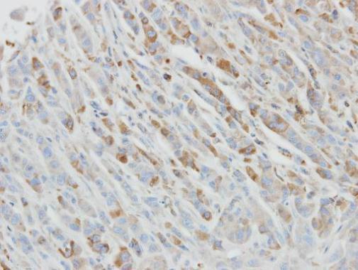 IL1 Receptor antagonist antibody