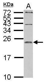 interleukin 1 receptor antagonist Antibody