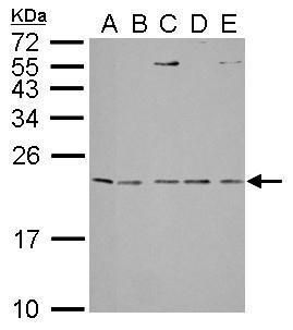 interleukin 1 receptor antagonist Antibody