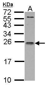 interleukin 1 receptor antagonist Antibody