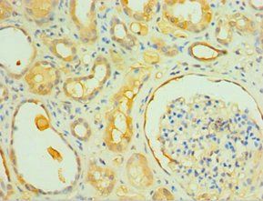 IL1R1 Antibody