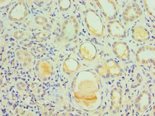 IL1R1 Antibody