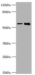 IL1 Receptor antibody