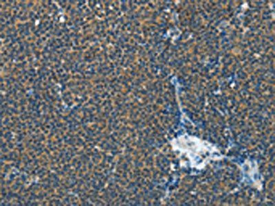 IL1R1 Antibody