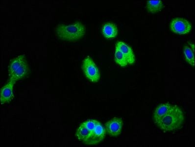 IL1R1 Antibody