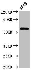 IL1 Receptor antibody