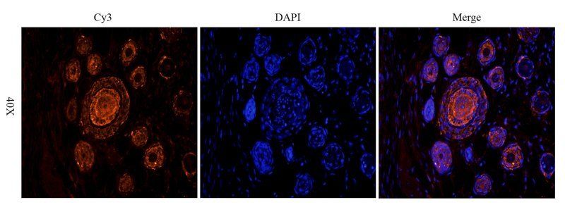 IL10 antibody