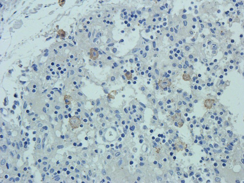 IL10 antibody