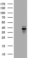 IL10RA Antibody