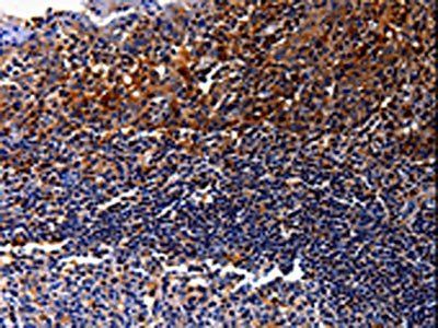 IL10RA Antibody